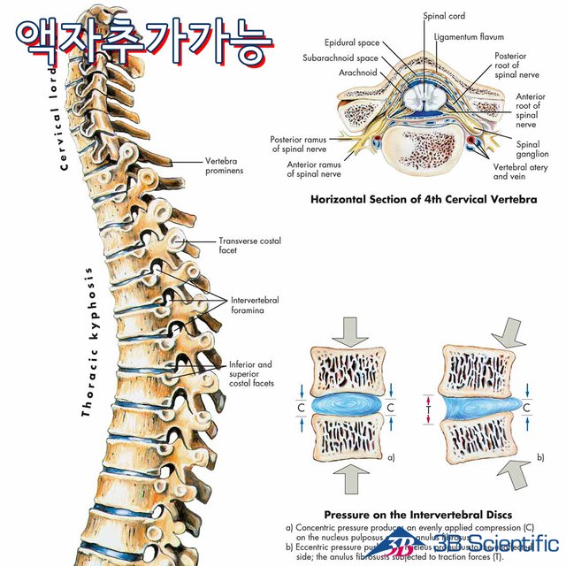 3B 척추차트 VR1152 Spinal Column 척추질병 병원액자_액자추가