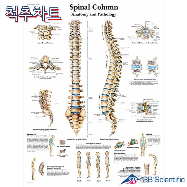 3B 척추차트 VR1152 Spinal Column 척추질병 병원액자_액자추가