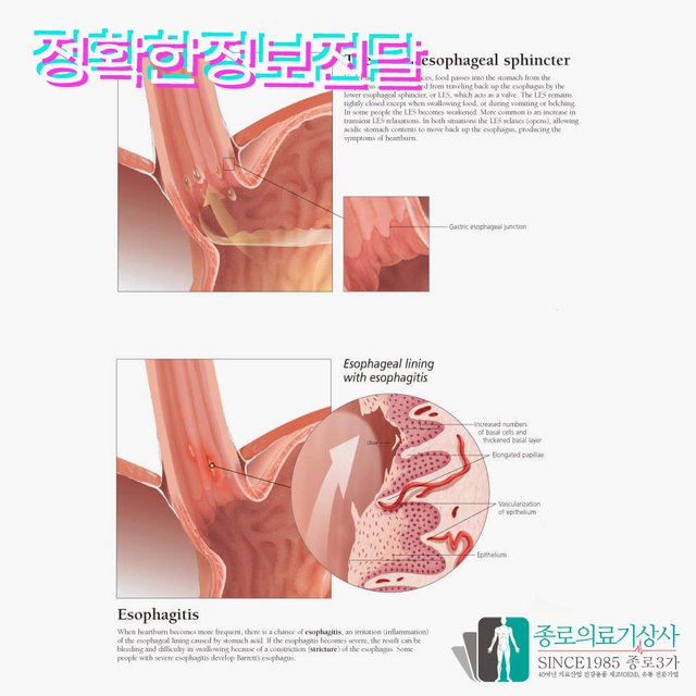 3B Scientific 손목관절 인체해부차트 VR1171 손과 손목 구조 병원액자_액자없음